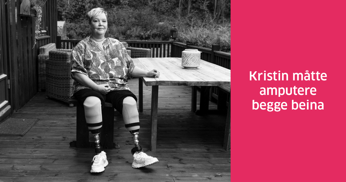 Kristin m&aring;tte amputere.png
